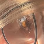 anemiclungs Profile Picture